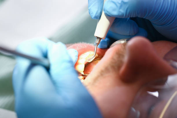 Best Broken Tooth Emergency  in Philadelphia, PA
